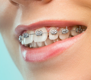 8 DICAS PARA MANTER A SAÚDE BUCAL